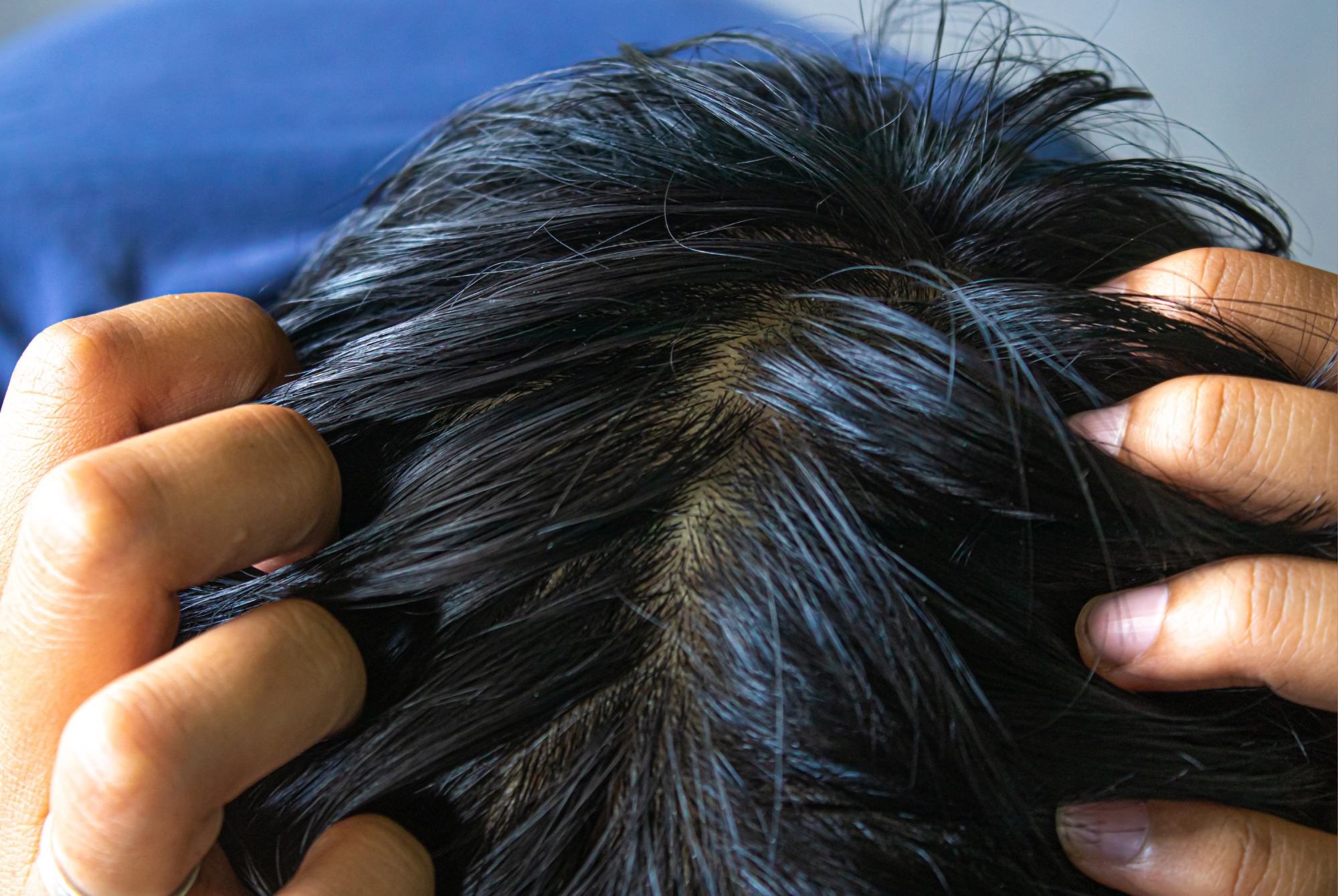 Misuse of a hair mask can lead to greasy hair.