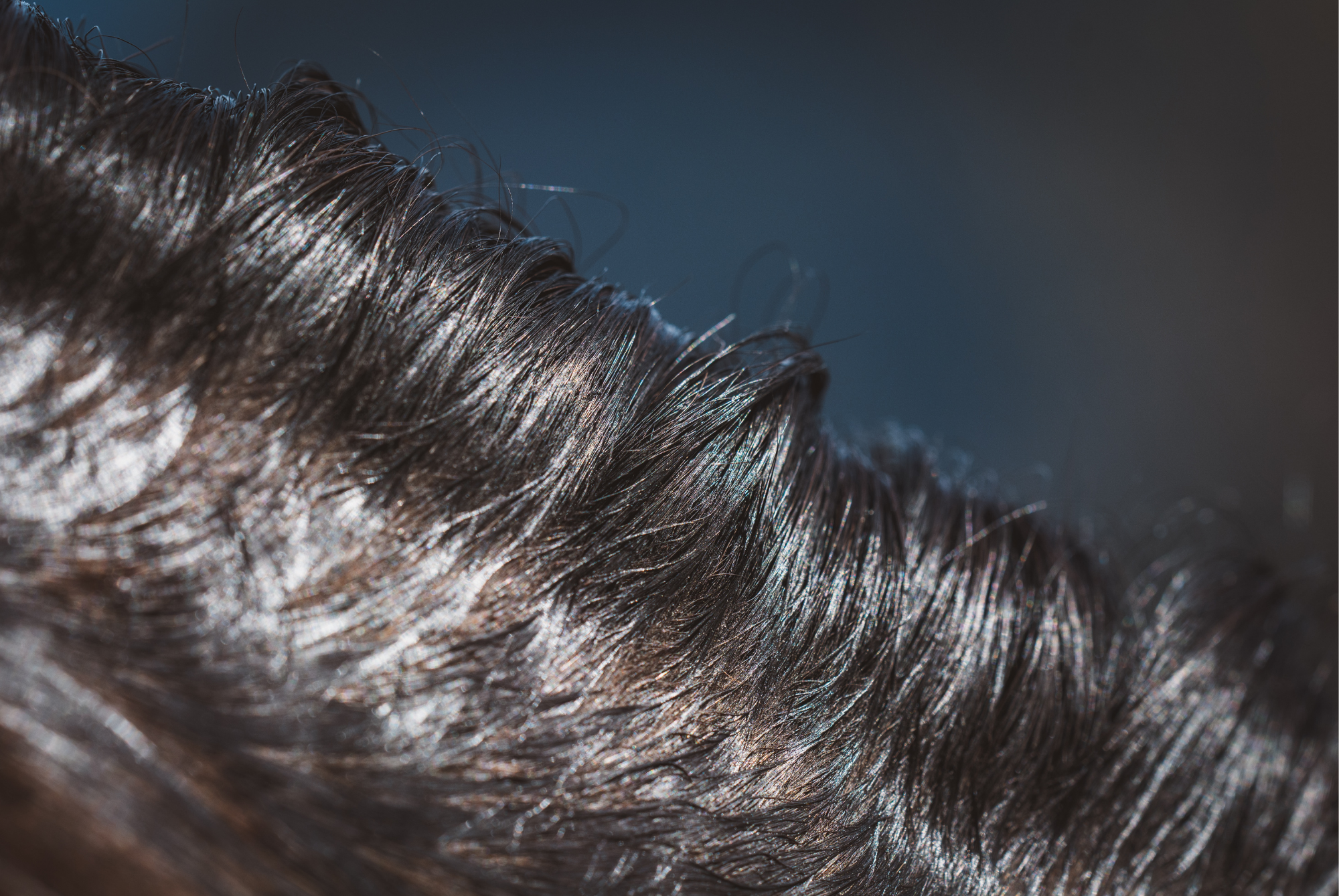 Oily hair can become more frequent if shampoo is too drying. 