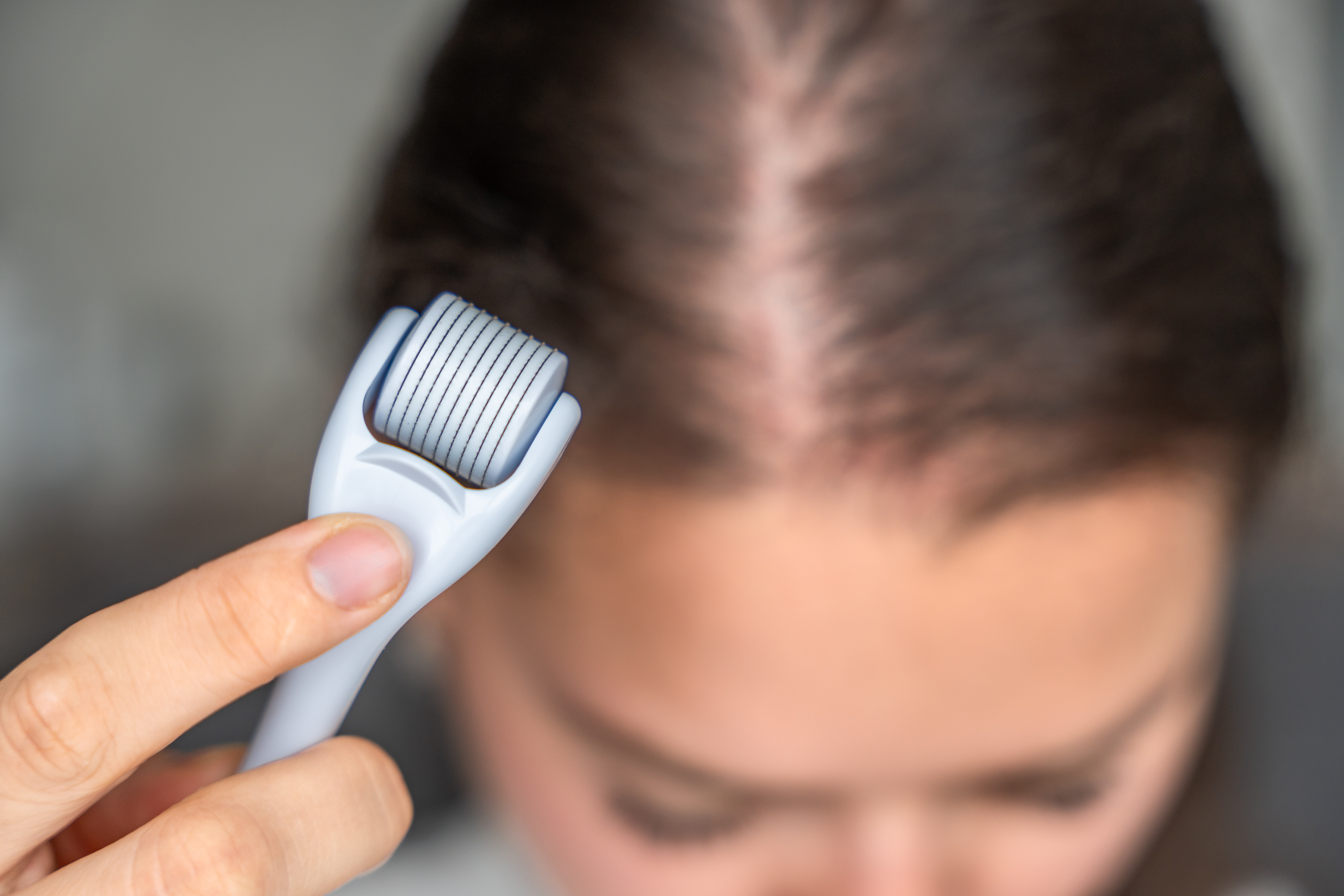 Microneedling