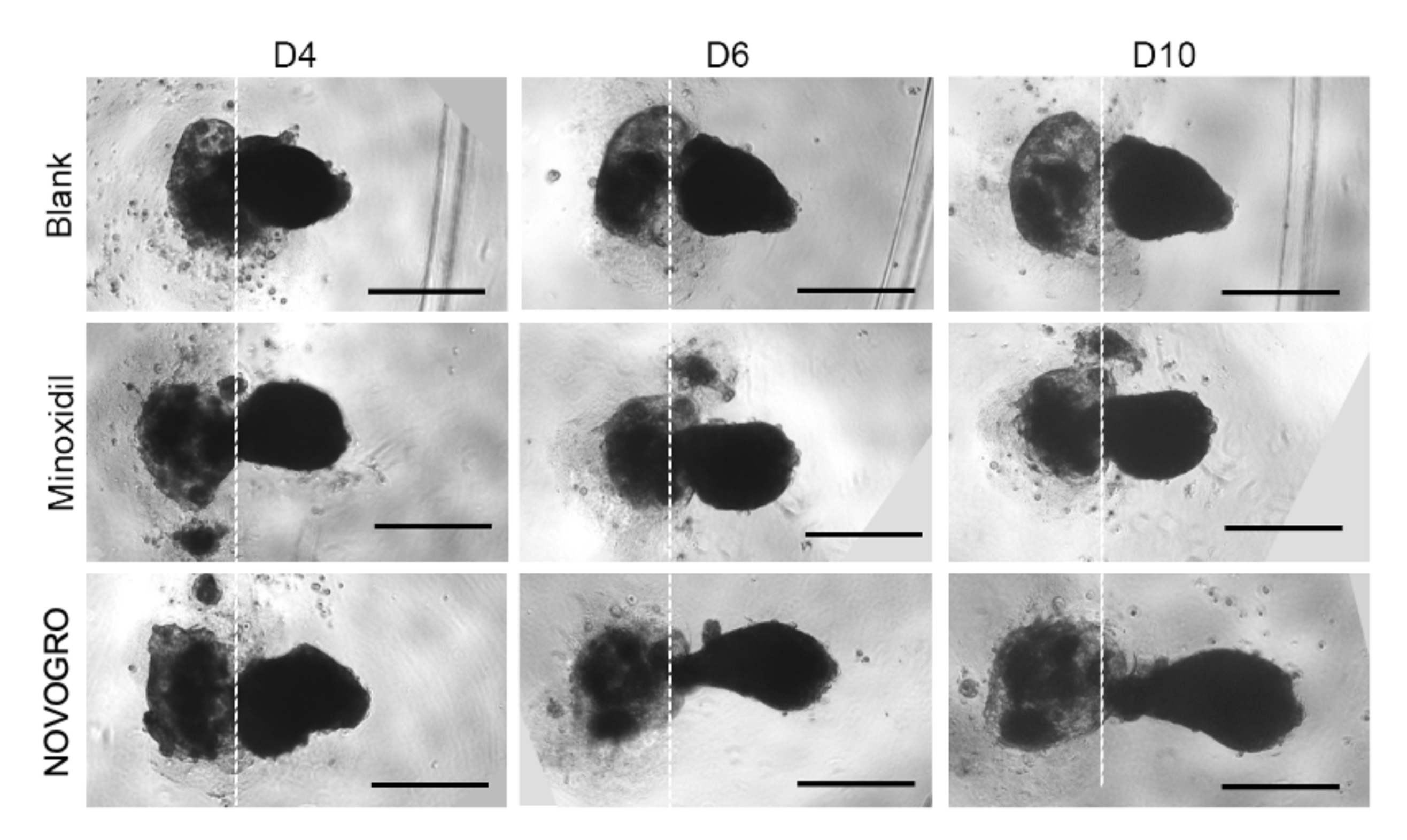 Preclinical hair follicloid imaging gives a visual snapshot of early growth activity, with the NOVOGRO™-treated mini follicle extending farther in the lab model (D4=Day 4, D6=Day 6; D10=Day 10).