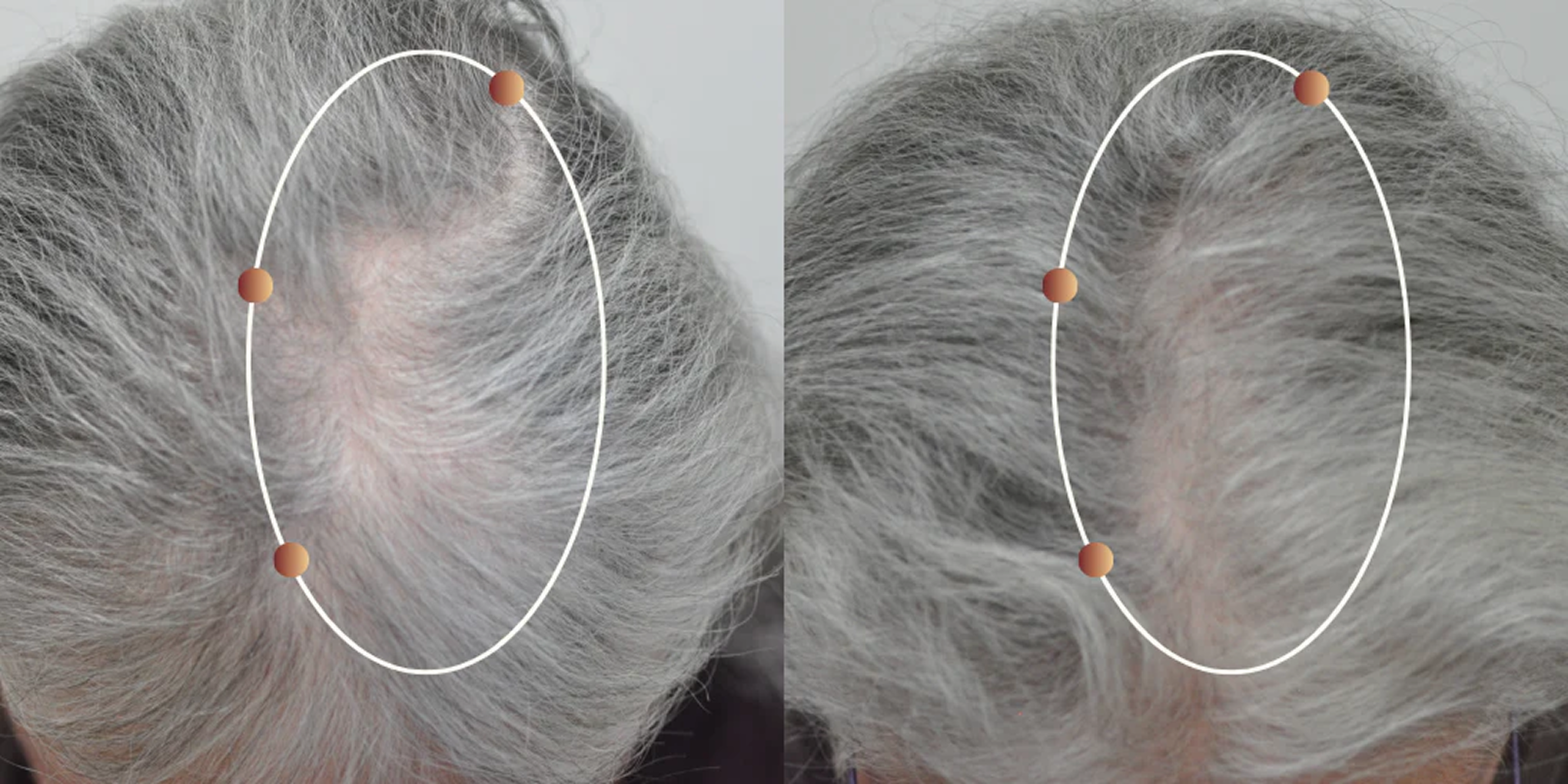 Before (left) and after (right) photos taken from [RE:YOU website](https://getreyou.com/products/dual-path-hair-revival-serum).