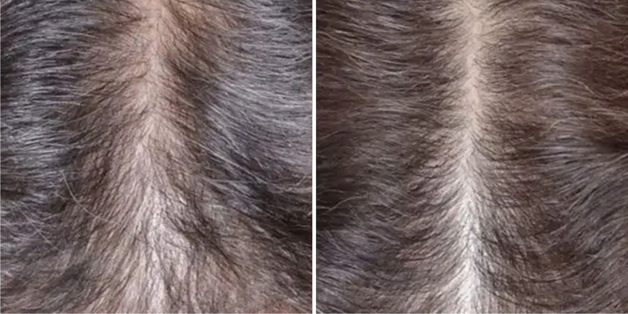 Before (left) and after (right) photos taken from [Rogaine website](https://www.rogaine.com/).